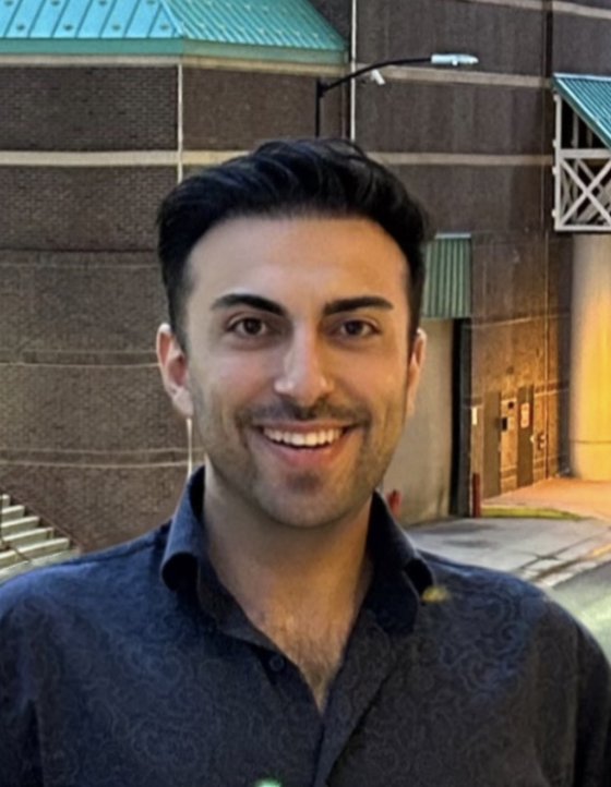 Caglar Genceldi after his hair transplant